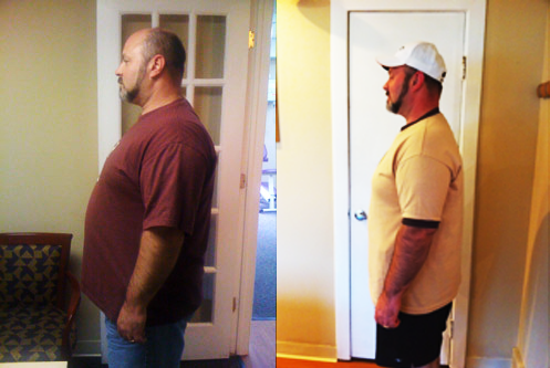 BEFORE AND AFTER