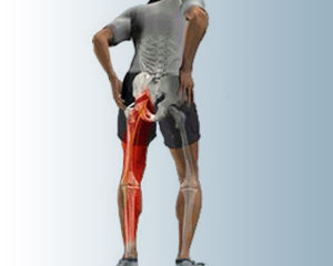 Sciatic Pain