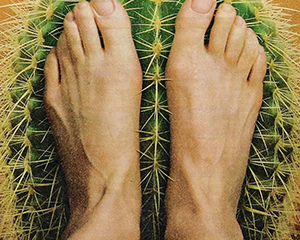 Peripheral Neuropathy